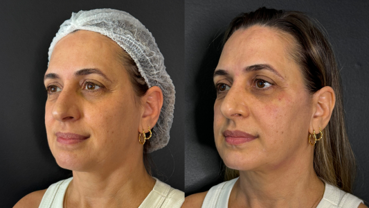 Procedimentos-Realizados-2