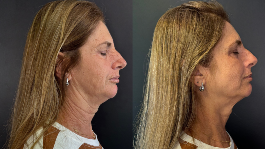 Procedimentos-Realizados-3